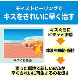 2号仓-NICHIBAN米琪邦 治愈之力系列透明防水创可贴 水胶体敷料促进伤口愈合 M号 12片