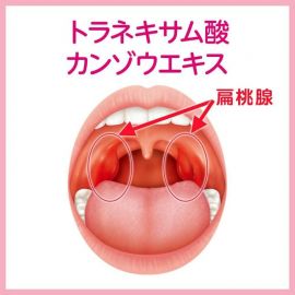 2号仓-小林制药 扁桃体发炎喉咙疼止痛冲剂 9包【第3类医药品】