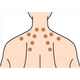 2号仓-兴和 舒缓肩颈肌肉关节不适 精准贴敷 缓解僵硬痛感 2.3cm 迷你圆形膏药贴 180枚【第3类医药品】 气味温和 局部位置护理 不显眼