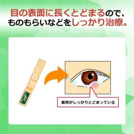 2号仓-ROHTO乐敦抗菌眼药水EX 结膜炎用眼药水 0.5ml*20支【第2类医药品】【寒冷地区勿拍，易冻结】
