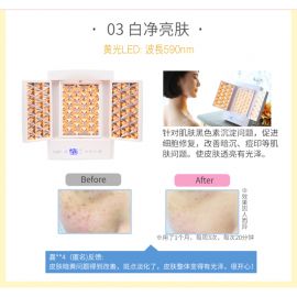 1号仓-belulu 光疗祛痘嫰肤 美容院级大排灯LED美容仪 1台 抗皱 淡化黑色素