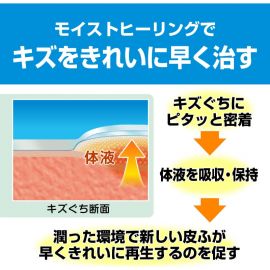2号仓-NICHIBAN米琪邦 治愈之力系列透明防水创可贴 水胶体敷料促进伤口愈合 L号 9片