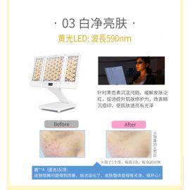 1号仓-belulu 光疗祛痘嫰肤 第3代美容院级大排灯LED＋红外线美容仪 1台 抗皱 红蓝光子嫩肤