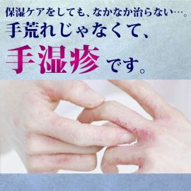 2号仓-ROHTO乐敦 曼秀雷敦 手部湿疹膏 消炎止痒 8g【指定第2类医药品】